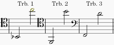 Strauss Death and Transfiguration